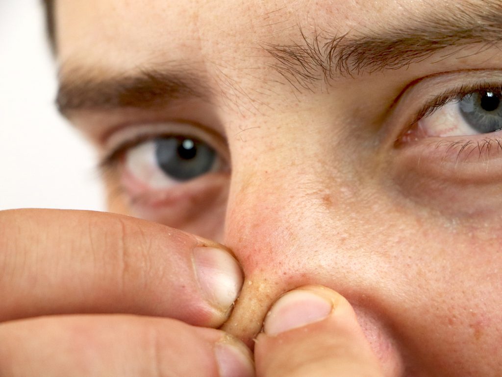 The Blackhead Files: Why Those Dark Spots Aren't What You Think (And How to Actually Get Rid of Them)