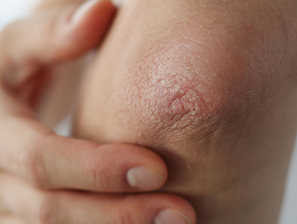 Creating a Skincare Routine for Dry Skin