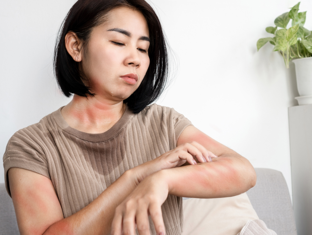 Dealing with Redness: Skincare Tips for Sensitive Skin