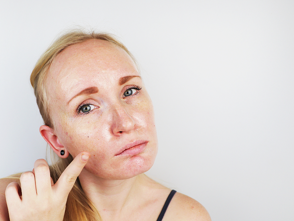 How to Control Shine and Reduce Excess Oil