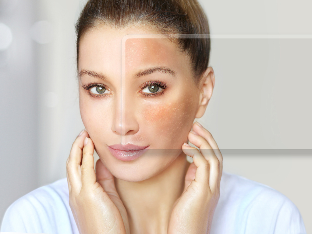 Fading the Past: Evidence-Based Approaches to Hyperpigmentation and Post-Inflammatory Marks