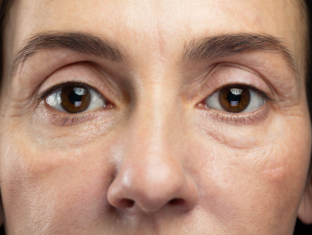 The Morning After: Causes and Solutions for Eye Puffiness at Any Age