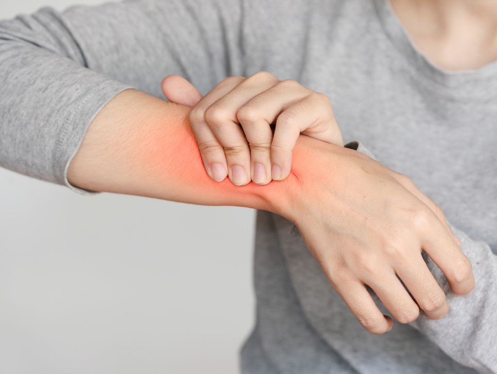 Calming the Flame: Strategies for Reducing Persistent Facial Redness