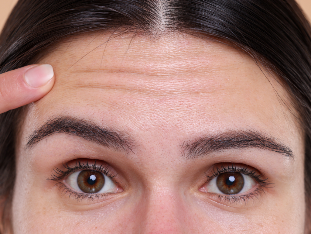 Forehead: When Your First Impression Gets Permanently Etched