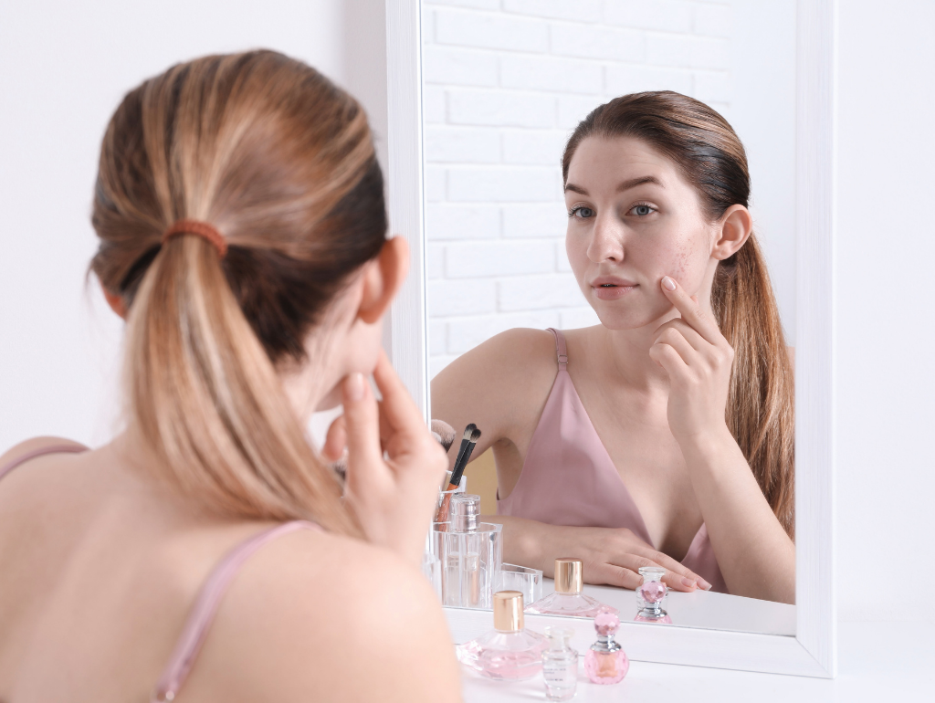 Hormonal Acne: The Monthly Skin Betrayal That's Actually Talking to You