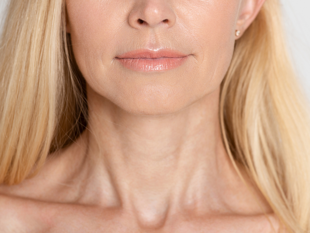 Neck: When Your Fountain of Youth Springs a Leak