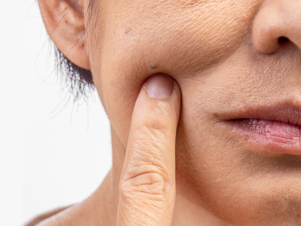 Sagging (Loss of Firmness): When Gravity Starts Winning the Battle