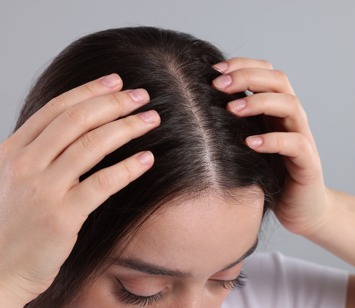Scalp Care