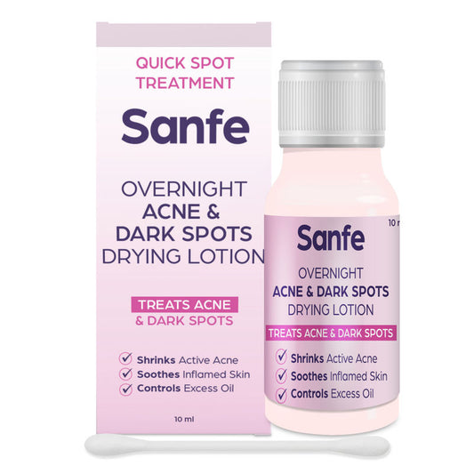 Sanfe Overnight Acne & Dark Spots Drying Lotion|For Acne, Dark Spots, Blackheads & Whiteheads, 10ml
